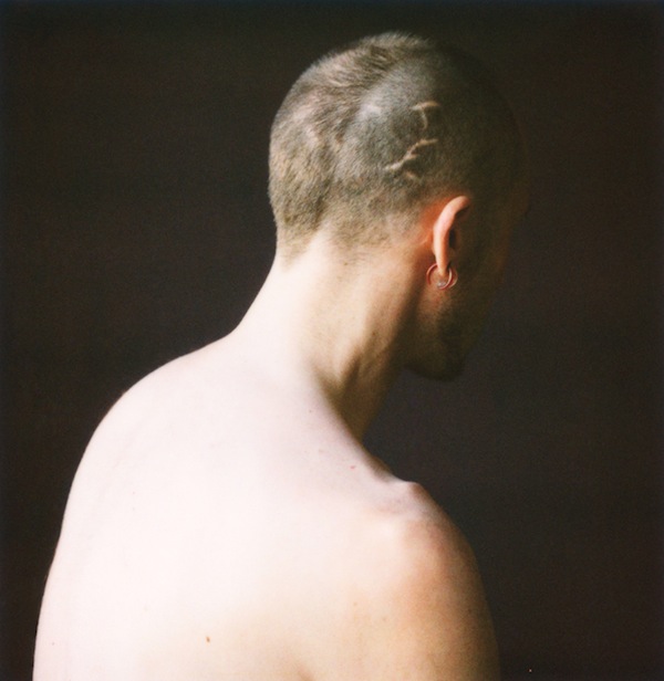 Walter or Scars from William, Brooklyn, Digital C-Print from Unique 600 Type Polaroid, 15 x 15 inches, 2011. SOLD